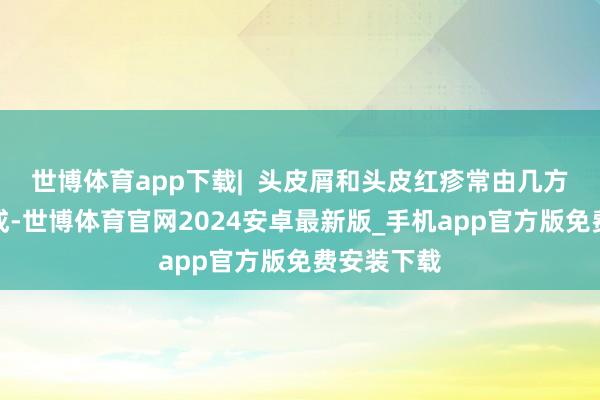 世博体育app下载|  头皮屑和头皮红疹常由几方面成分形成-世博体育官网2024安卓最新版_手机app官方版免费安装下载